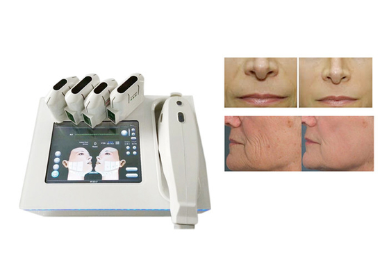 Mini Salon Use Hifu Facelift Treatment Wrinkle Removal Sagging Skin Therapy