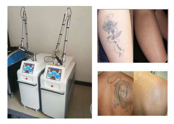 CE Approved ND YAG Laser Tattoo Removal Machine For Laser Pigmentation Removal